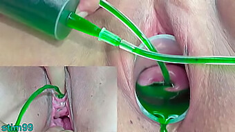 Japanese Lesbian'S Extreme Pleasure With Cervix And Pee Hole Expansion Using Injections